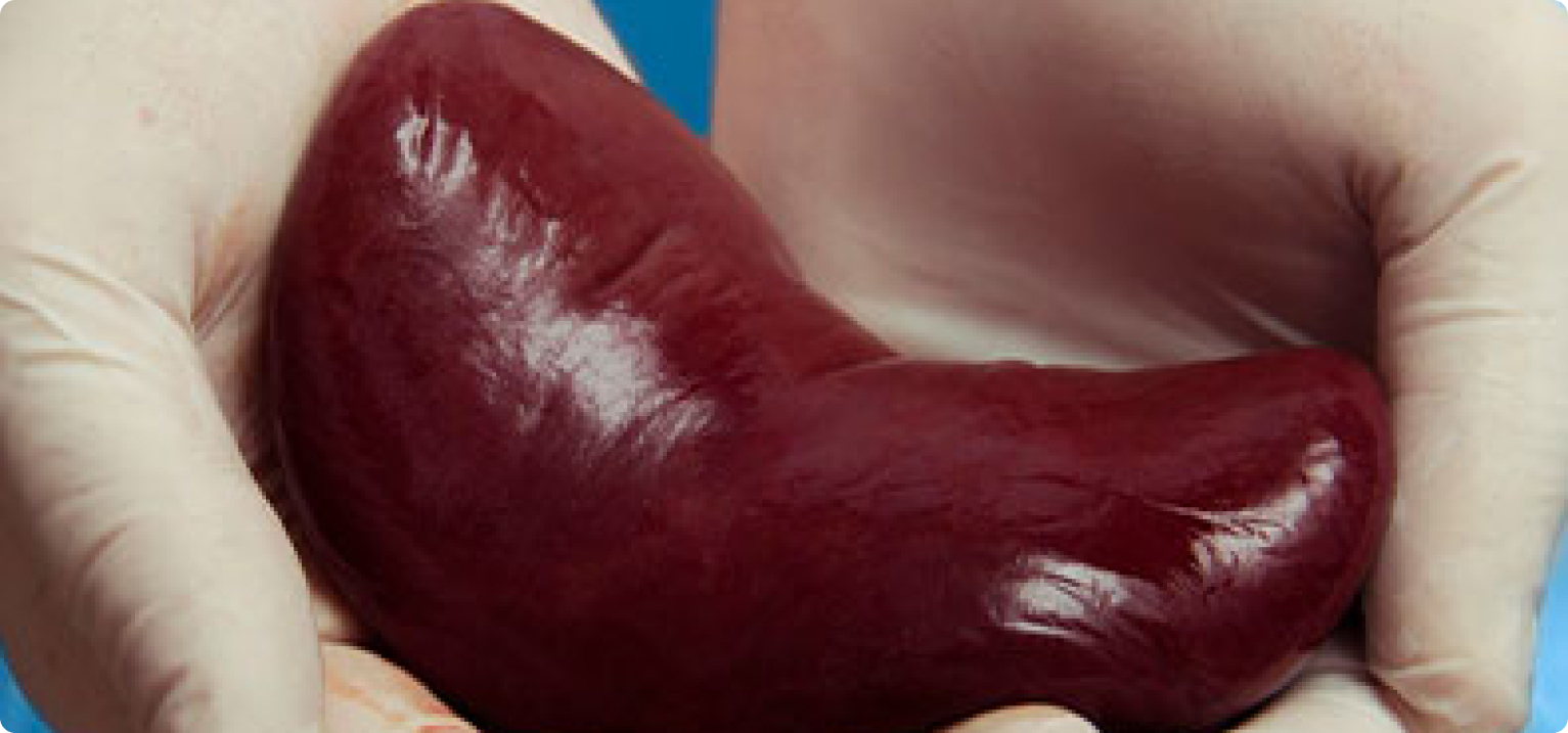Processo de transplante: