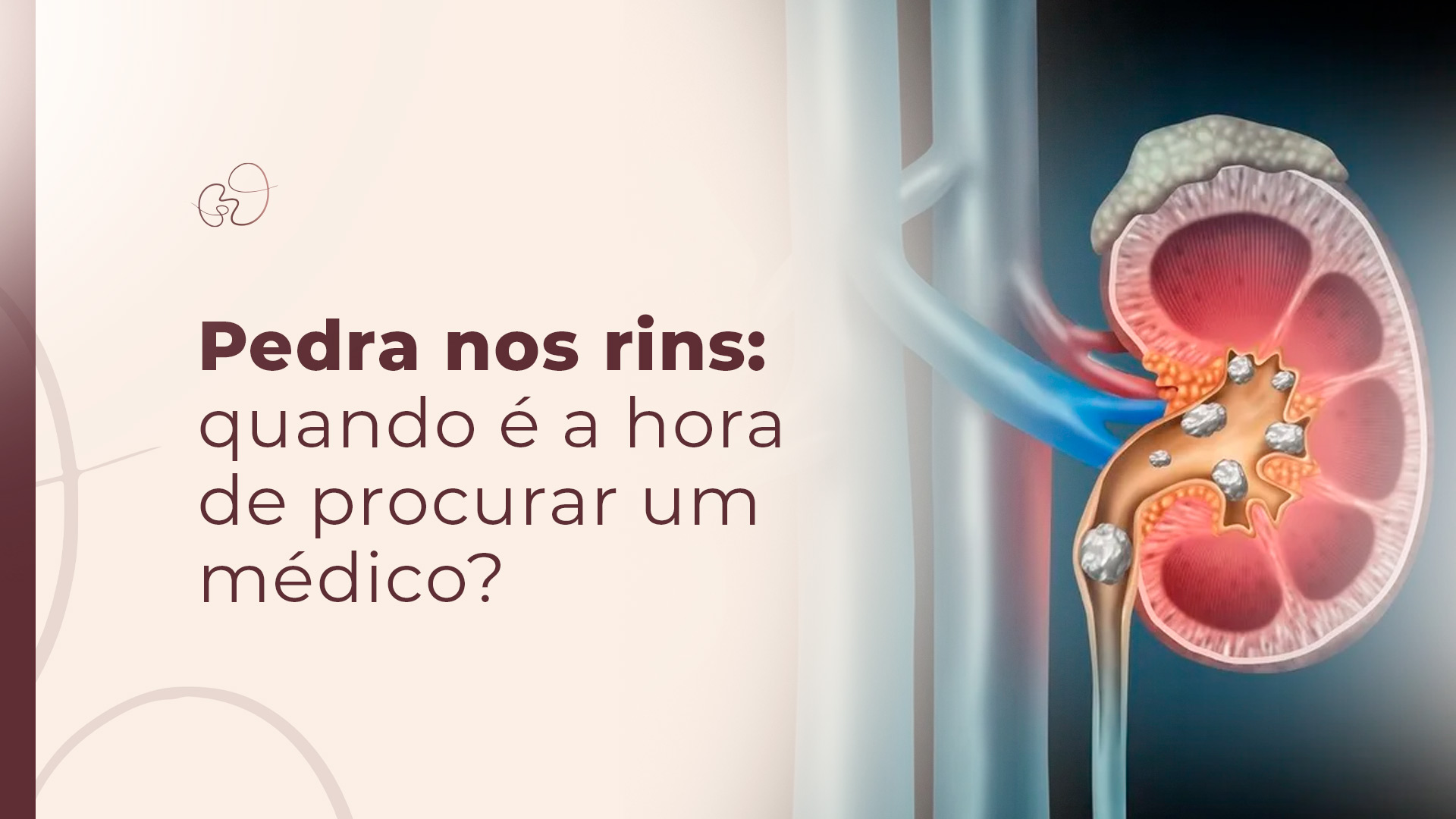 Pedra nos rins: quando é a hora de procurar um médico?