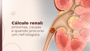 Cálculo renal: quando procurar um nefrologista em São Paulo?