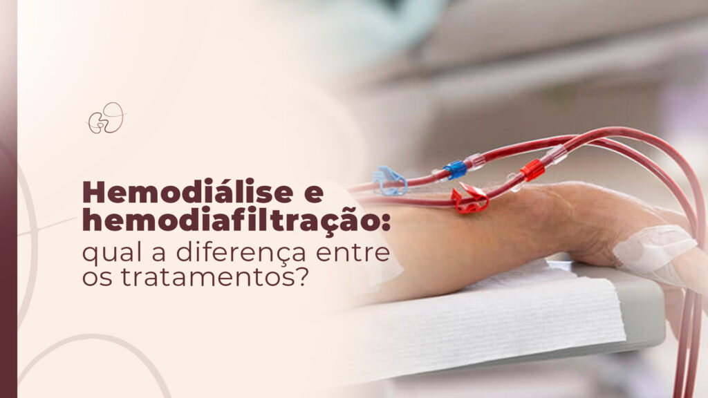 Hemodiálise ou HDF em SP: Qual a diferença para o tratamento?