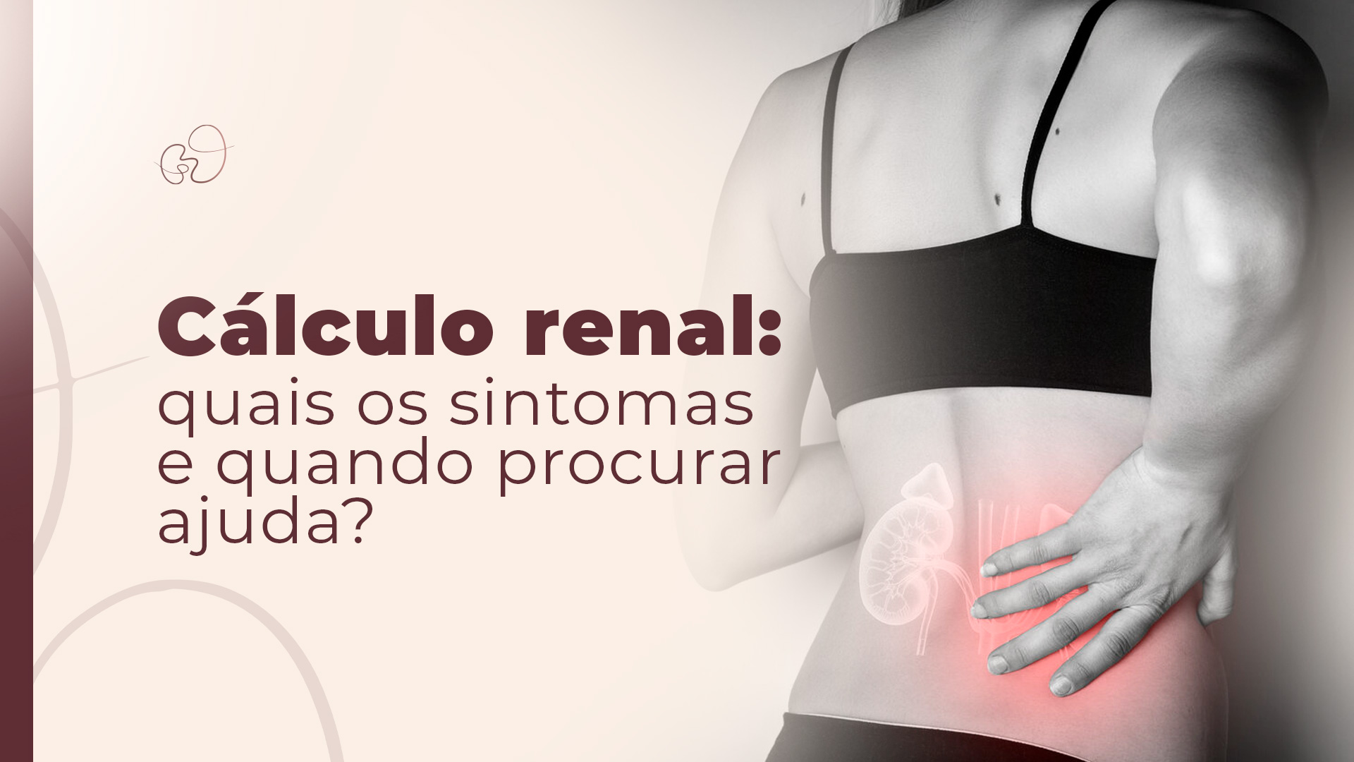 Cálculo renal: quais os sintomas e quando procurar ajuda em SP?