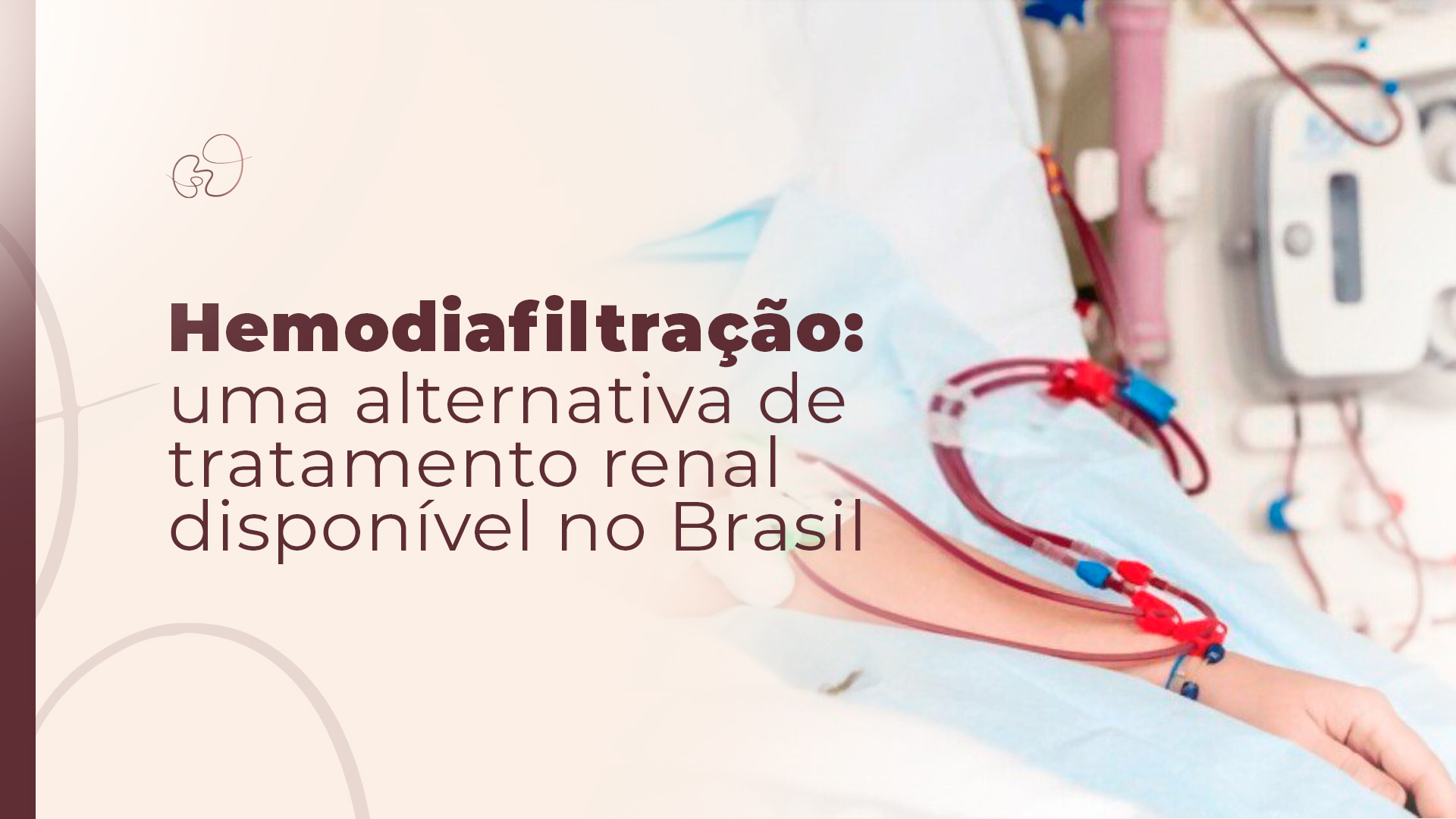 Hemodiafiltração no Brasil: como funciona o tratamento