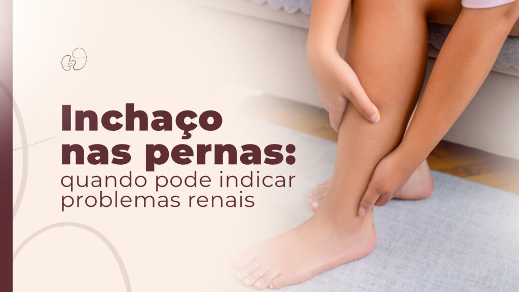 Inchaço nas pernas: quando pode indicar problemas renais em SP