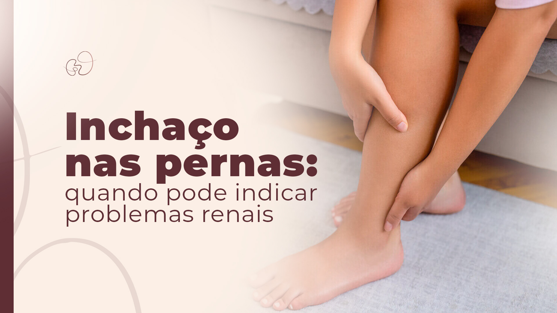 Inchaço nas pernas: quando pode indicar problemas renais em SP