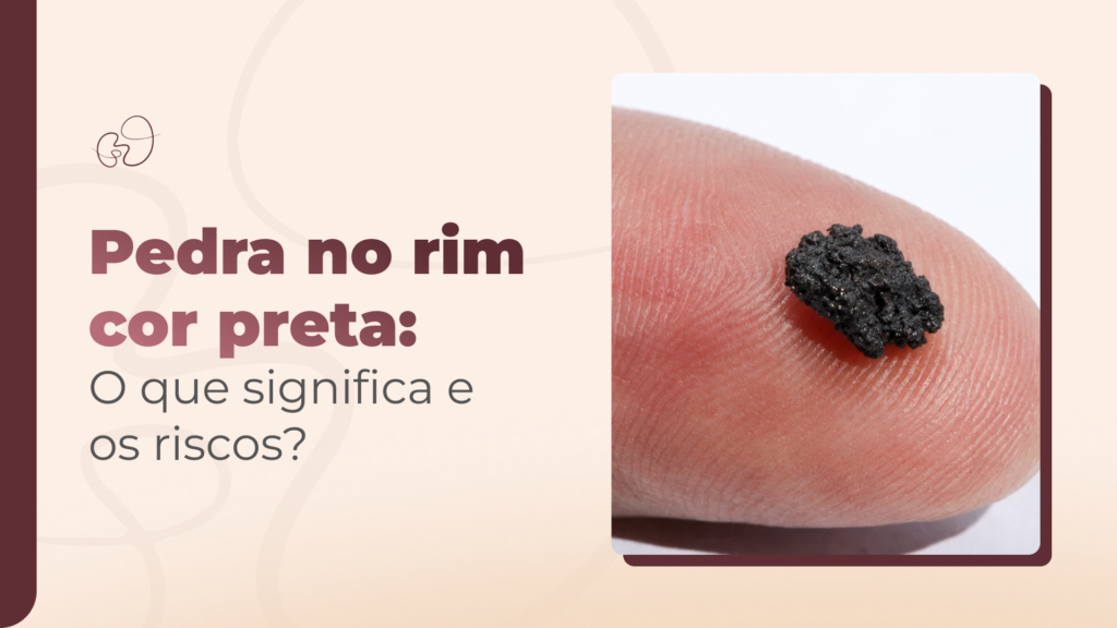 Pedra no rim cor preta: O que significa e os riscos?